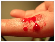 Blutender Finger